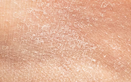 Our Amazing Skin- Ashy Larry & Mitosis · Science in the City